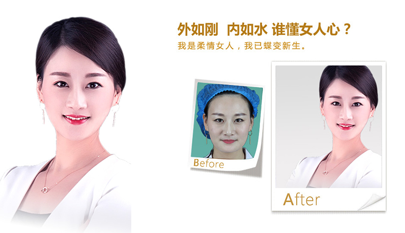 绍兴V脸、线雕隆鼻